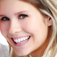 Illustration for article titled Can bleaching help you to get your shiny teeth back?